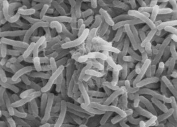 Cholera bacteria SEM الصحة العراقية: ارتفاع عدد الإصابات بمرض الكوليرا إلى 894 حالة