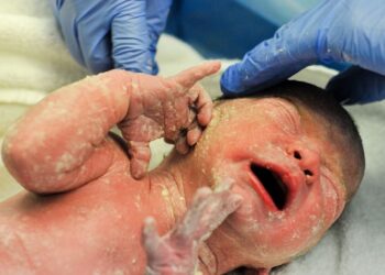 مسح الرضع بالافرازات المهبلية