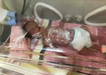 161 الإهمال الطبي بمستشفى الدمرداش يتسبب في وفاة الطفل ياسين العربي