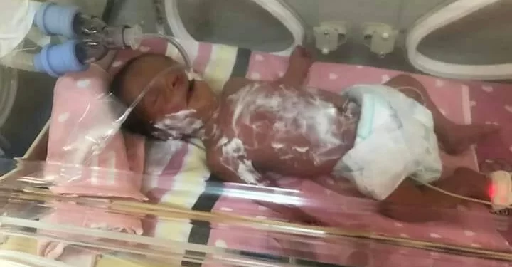 161 الإهمال الطبي بمستشفى الدمرداش يتسبب في وفاة الطفل ياسين العربي