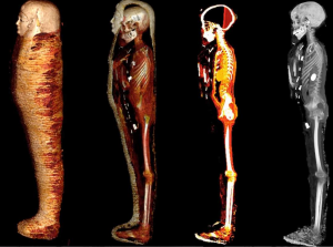 6633 اكتشاف أثري ببدروم المتحف المصري.. 100 عام على اكتشاف «مومياء الصبي الذهبي».. والآشعة المقطعية تفجر مفاجأة (صور)