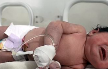 ملةملانةل e1677066650684 مفاجأة بشأن الطفلة المعجزة بعد ولادتها تحت أنقاض الزلزال في سوريا
