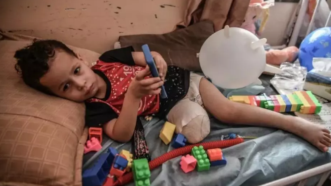 الطفل البطل غزة : 10 أطفال يفقدون سيقانهم يوميًا