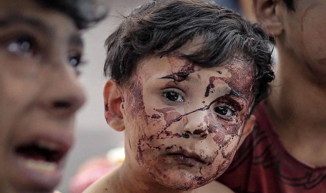 عدد الاطفال القتلى في غزة